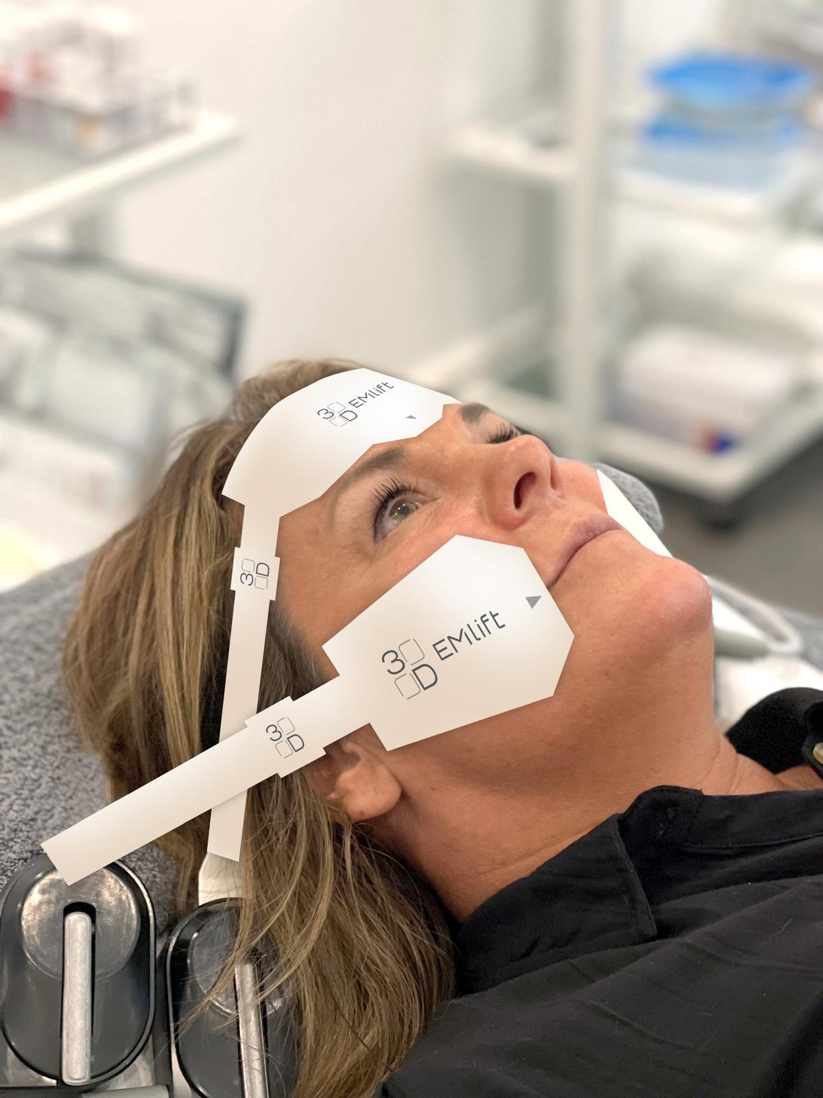 3D EMLift Treatment