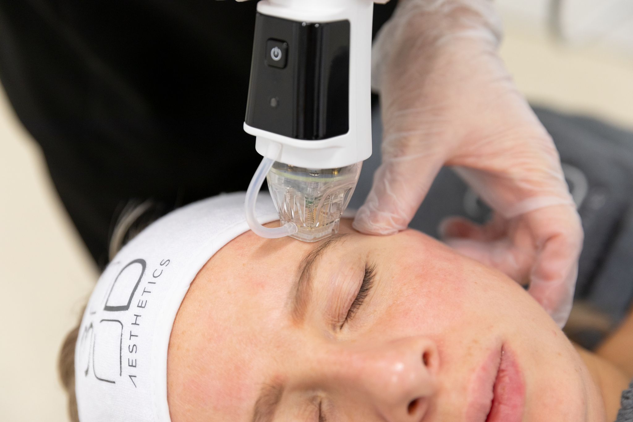 Microneedling